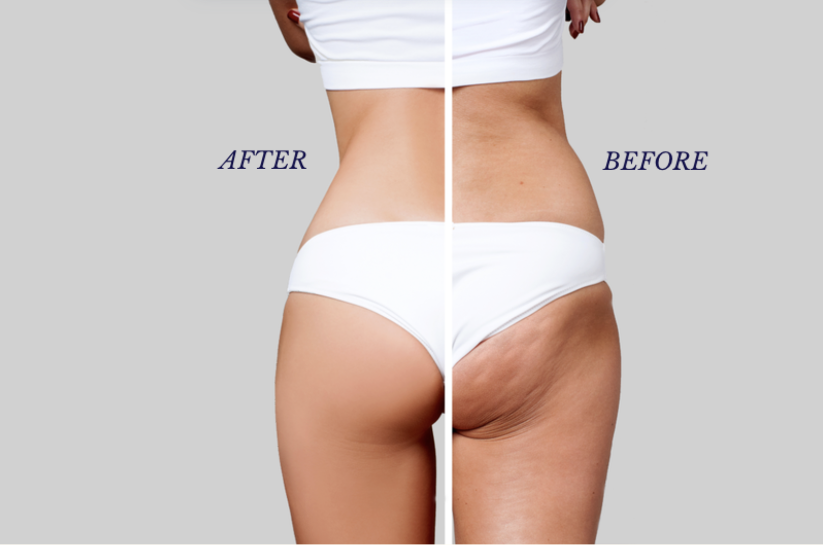 <span style='font-size: 0.875rem;'>Cryo Body Sculpting</span>